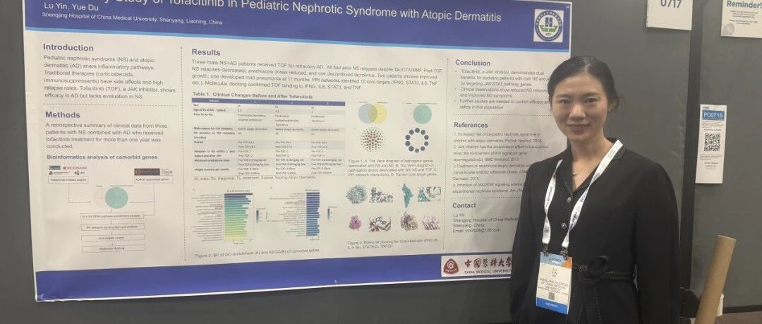 盛京医院研究：JAK抑制剂托法替布或为合并特应性皮炎的儿童肾病综合征的治疗提供新思路