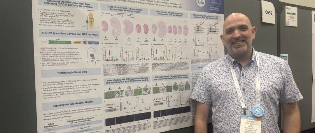 SN壁报精选 | 研究者解读：揭示肾囊性变的“油门”：纤毛蛋白ARL13B驱动PKD发生的关键机制