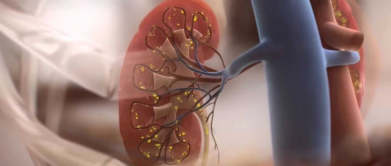 毛建华教授团队综述：抗B细胞治疗在肾病综合征中的新进展——超越利妥昔单抗