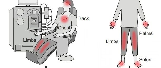 慢性肾脏病相关瘙痒在血液透析中的流行病学、诊断与治疗