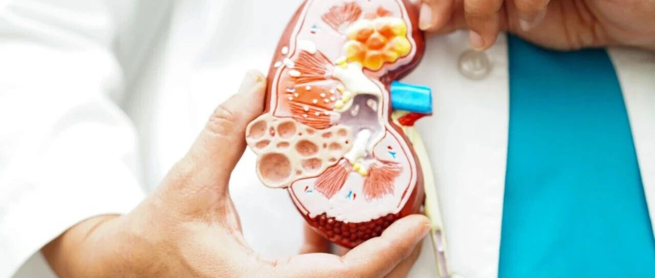 中大医院三项研究揭示急性肾损伤靶向治疗新机制：人间充质干细胞来源的细胞外囊泡丨APCN 2025中国研究成果精选