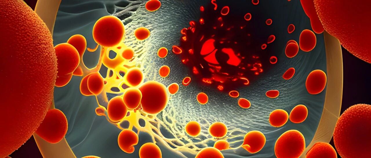 APCN 2025口头报告精选：血液透析领域值得关注的7大研究进展