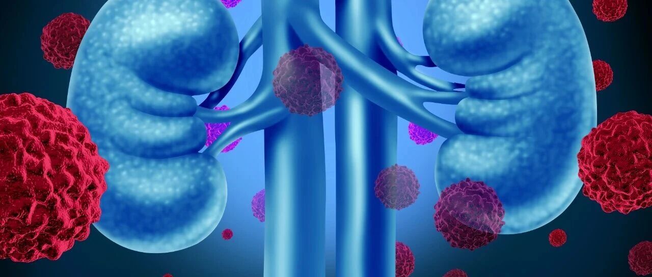突破治疗边界：SGLT2i在非糖尿病非蛋白尿CKD中的肾脏保护新证据