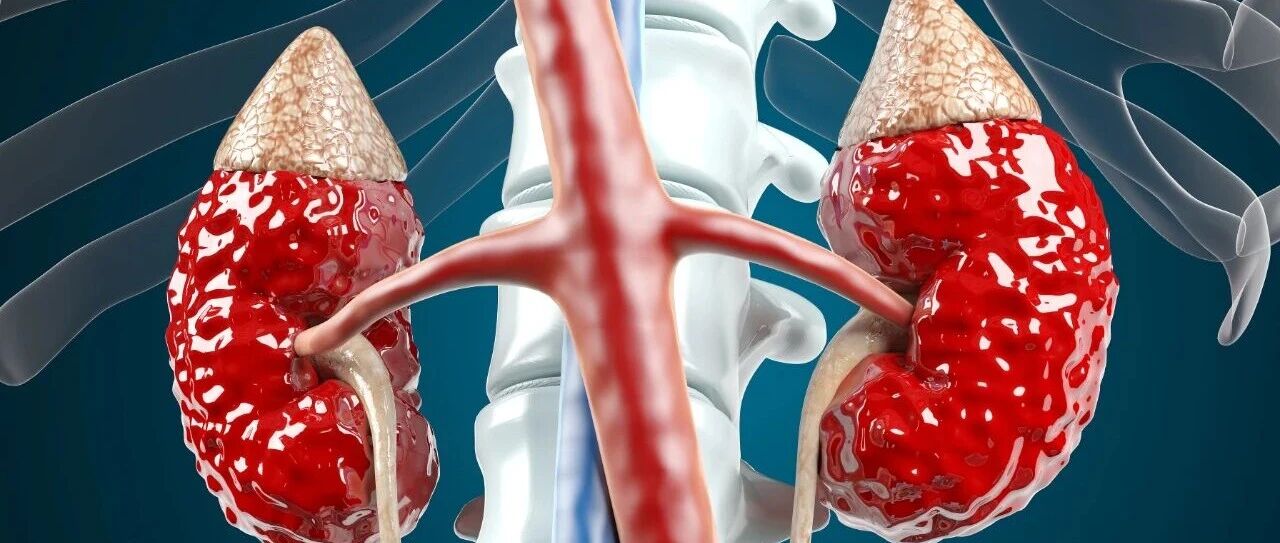 APCN 2025急性肾损伤口头报告研究精华：从生物治疗、器官保护到临床干预的新突破